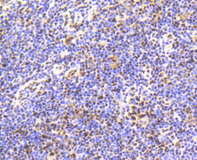 Phospho-Smad5(S463/465) Rabbit mAb