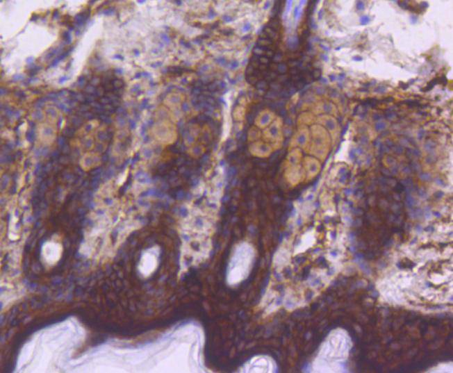 Phospho-EGFR(Y1092) Rabbit mAb