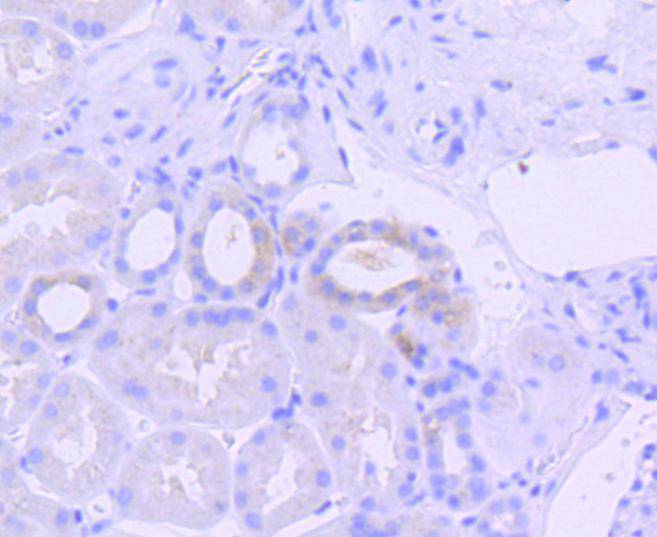 Phospho-PKR(T446) Rabbit mAb