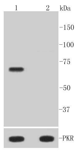 Phospho-PKR(T446) Rabbit mAb