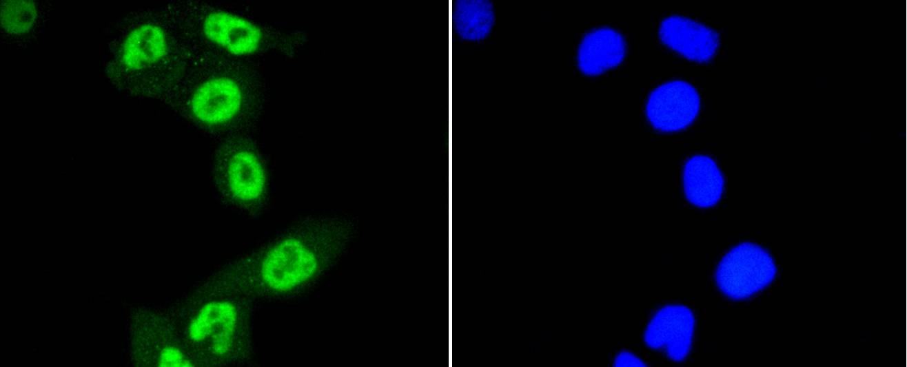 Phospho-STAT3(S727) Rabbit mAb