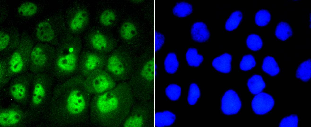 Phospho-STAT3(S727) Rabbit mAb