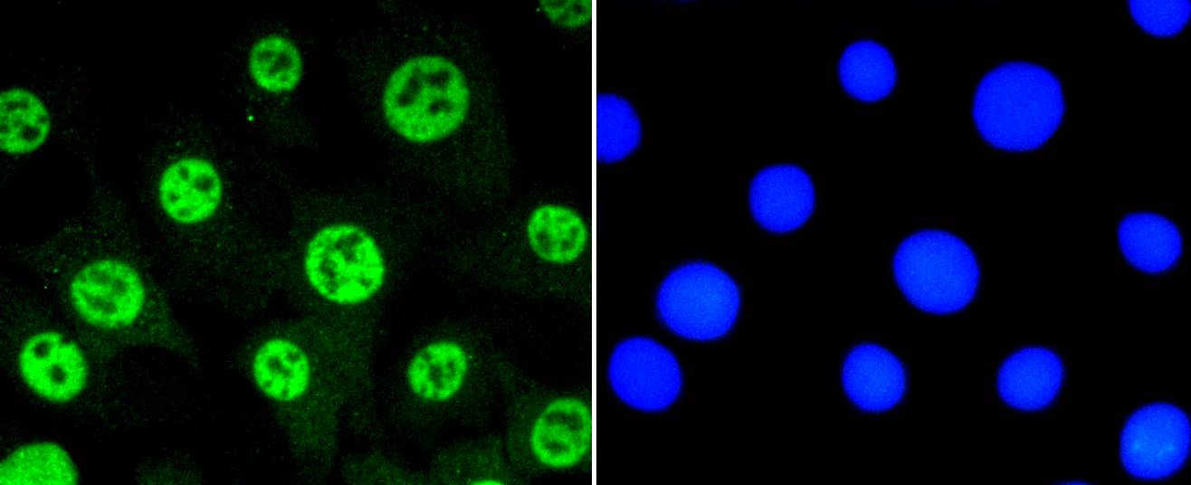 Phospho-STAT3(S727) Rabbit mAb