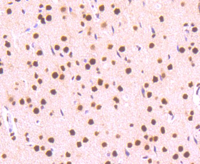 Phospho-STAT3(S727) Rabbit mAb