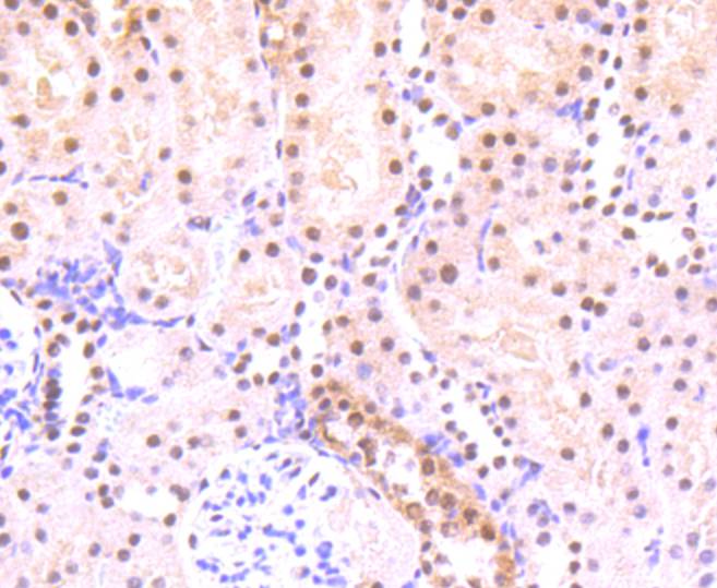 Phospho-STAT3(S727) Rabbit mAb