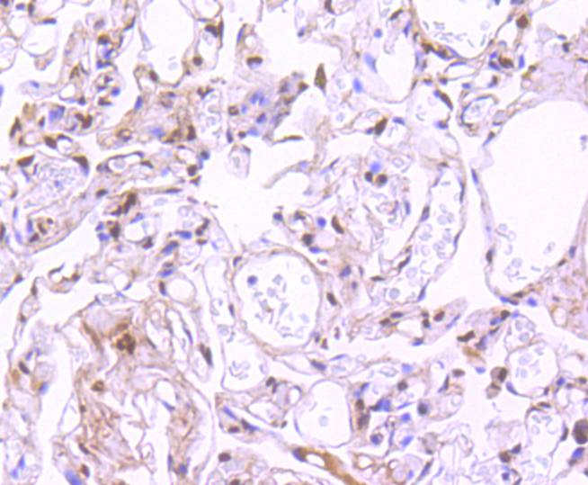 Phospho-STAT3(S727) Rabbit mAb