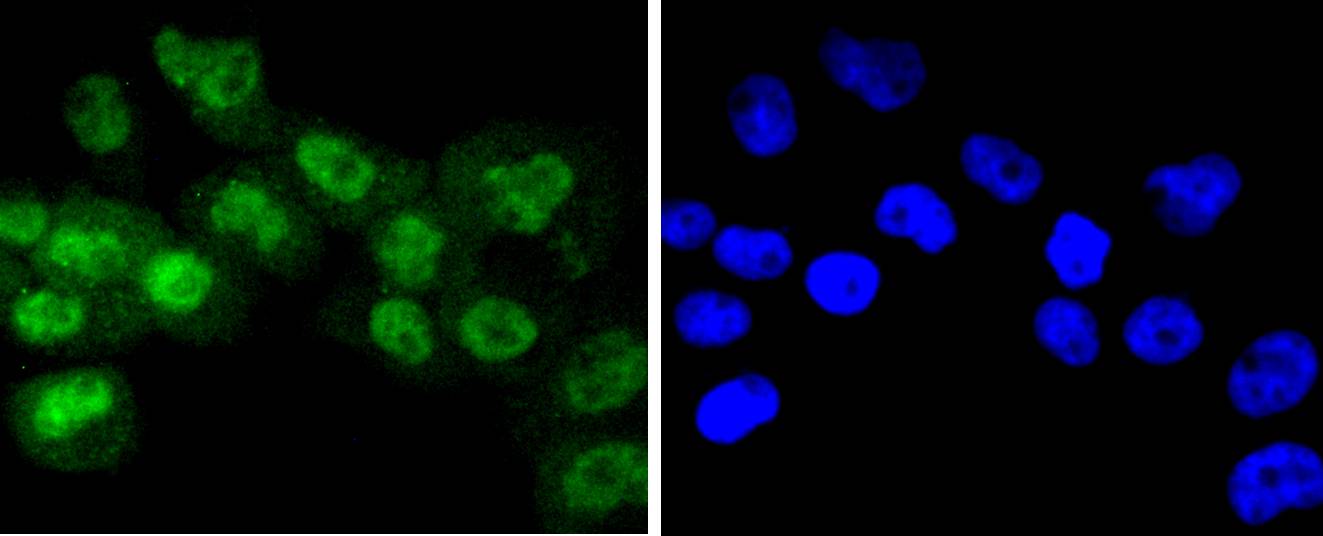 Phospho-RSK1 p90(T359+S363) Rabbit mAb