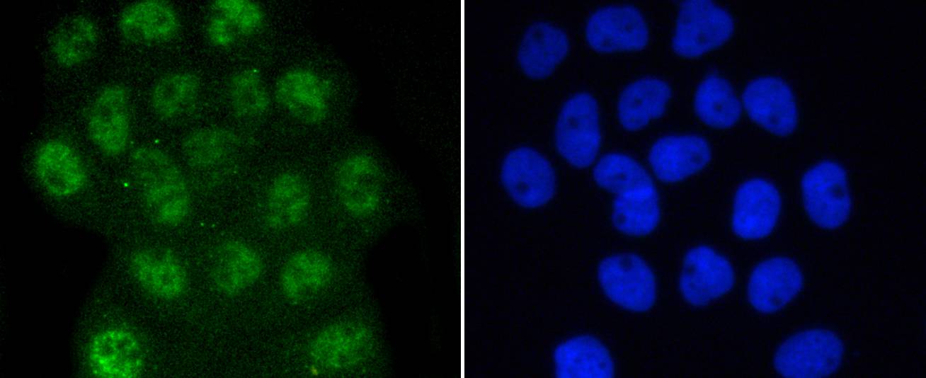 Phospho-Smad3(S423/S425) Rabbit mAb