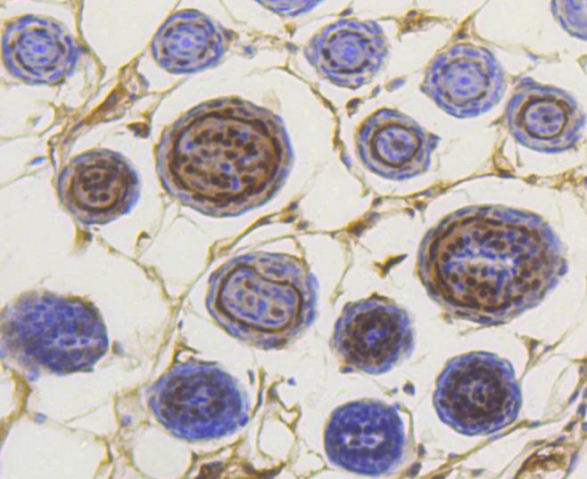 Phospho-Smad3(S423/S425) Rabbit mAb