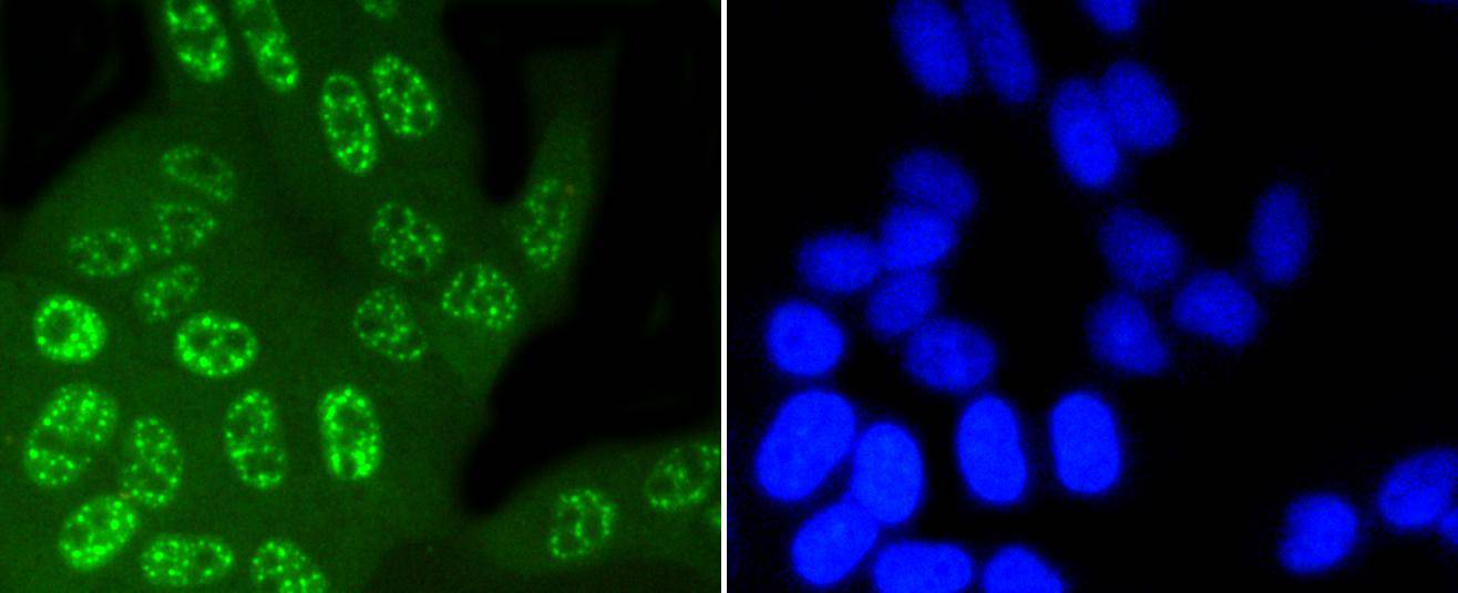 Phospho-JNK1/2/3(T183+T183+T221) Rabbit mAb