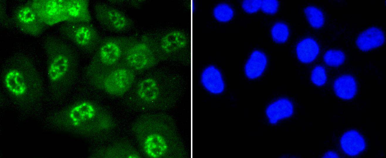 Phospho-JNK1/2/3(T183+T183+T221) Rabbit mAb