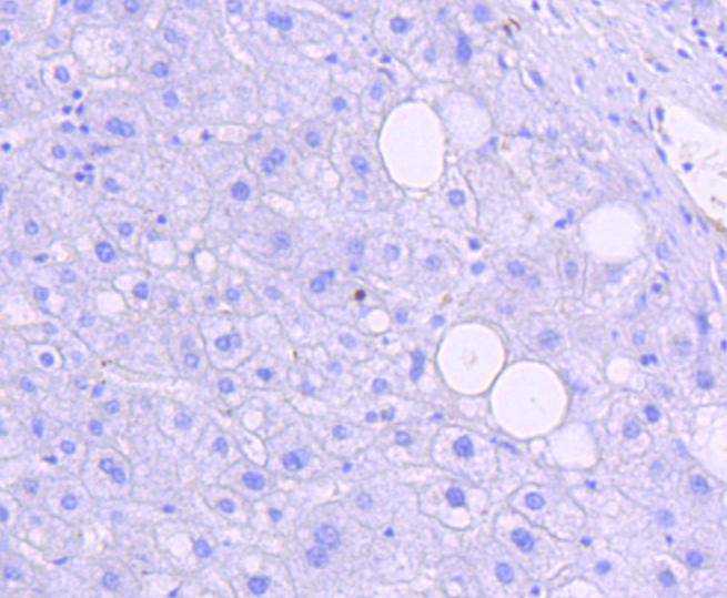 Phospho-JNK1/2/3(T183+T183+T221) Rabbit mAb