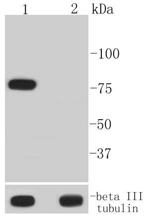 Phospho-BTK(Y223) Rabbit mAb