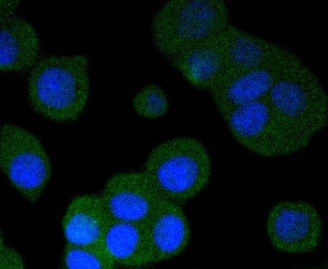 Phospho-PKA R2 (S99) Rabbit mAb