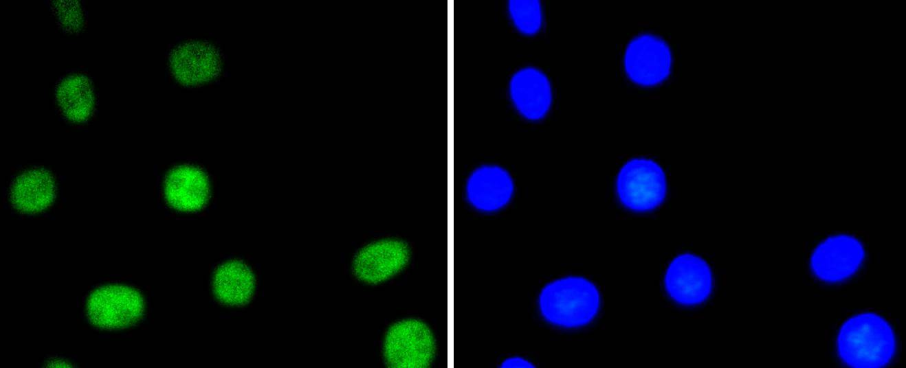 Phospho-ATF2(T71) Rabbit mAb