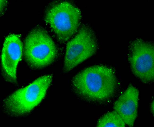 Phospho-Estrogen Receptor alpha(S118) Rabbit mAb