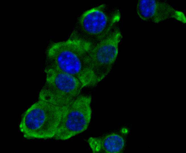 Phospho-EGFR (pY1173) Rabbit mAb