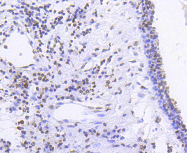 Phospho-SMC1(S957) Rabbit mAb