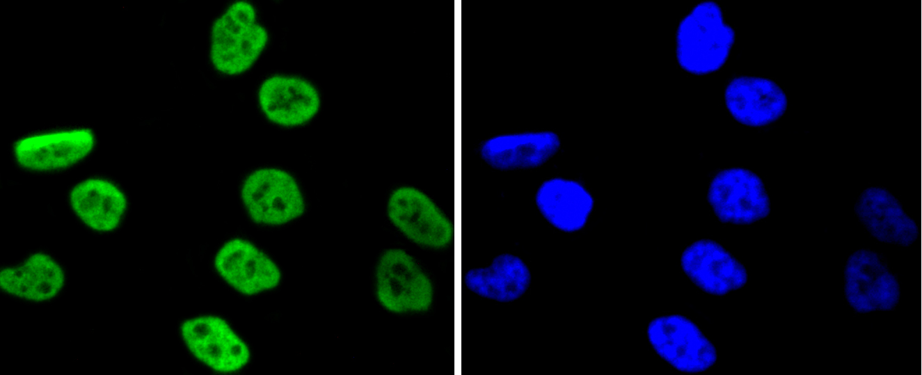 MSK1(phospho S376) Rabbit mAb