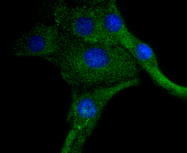 PDGF Receptor beta(phospho Y740) Rabbit mAb