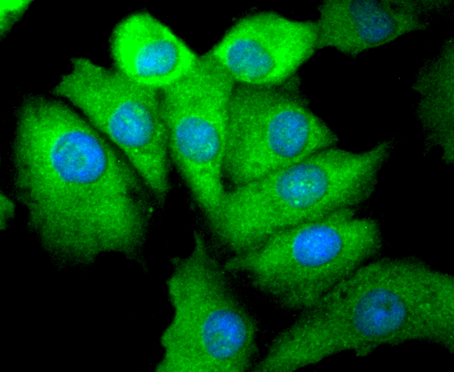 Phospho-EGFR(S695) Rabbit mAb