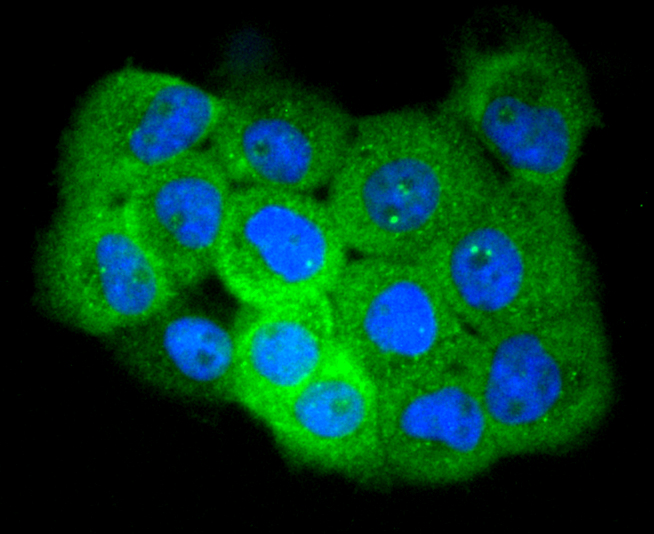 Phospho-EGFR(S695) Rabbit mAb