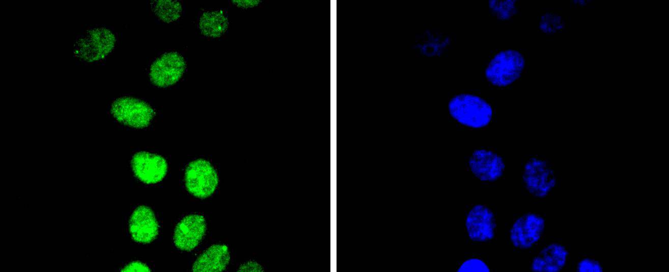 Phospho-Cyclin E1(T77) Rabbit mAb