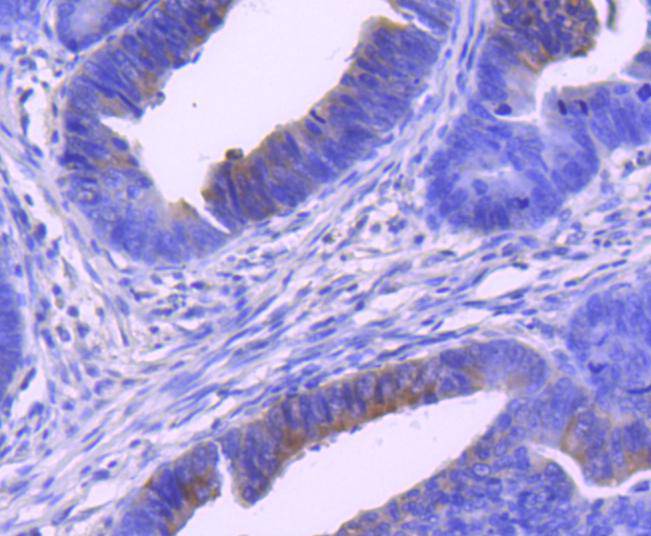 Phospho-MEK1 (S298) Rabbit mAb