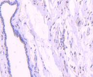 Phospho-AKT1 (T450) Rabbit mAb