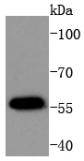 Phospho-AKT1 (T450) Rabbit mAb