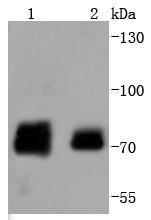 Phospho-Raf1 (S259) Rabbit mAb