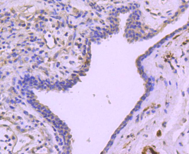 Phospho-Hsp27(S78) Rabbit mAb