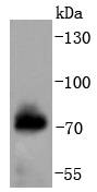 Phospho-Raf1(S621) Rabbit mAb