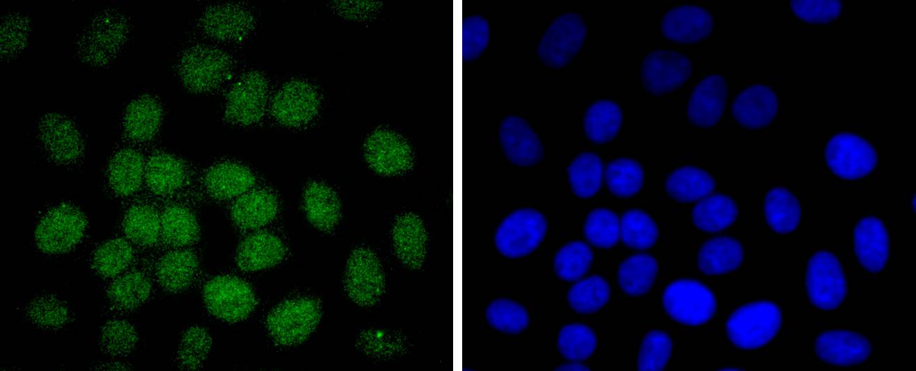 Phospho-c-Jun(T91) Rabbit mAb