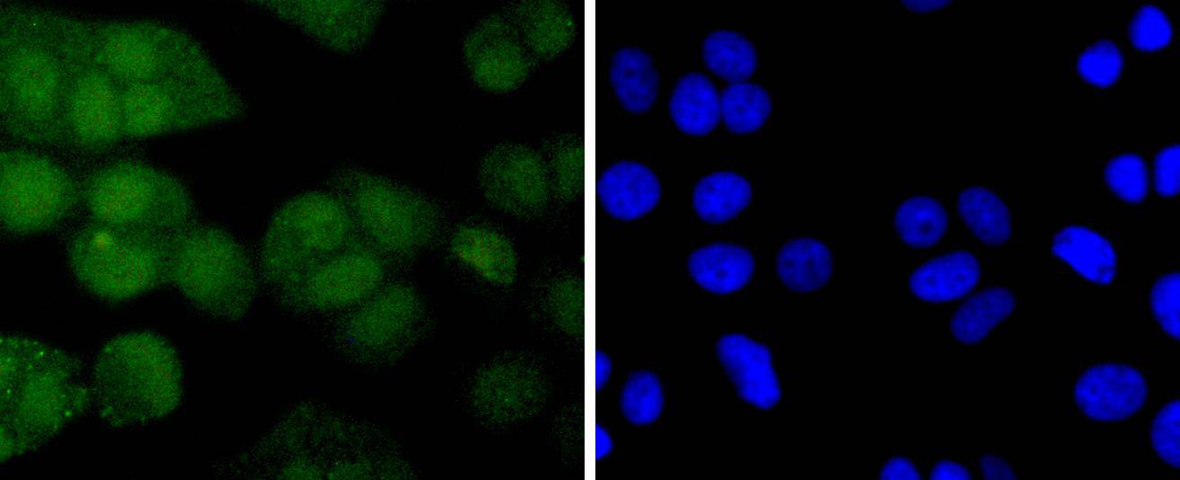 Phospho-AKT1(S124) Rabbit mAb