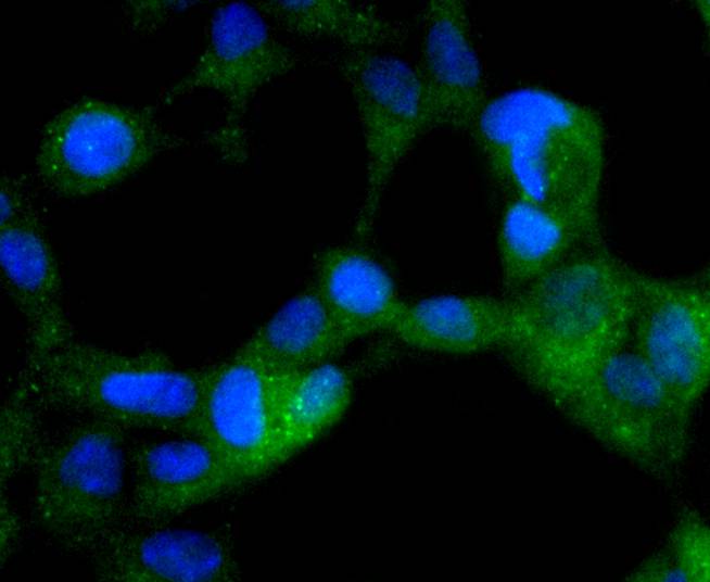 Phospho-AMPK alpha 2(S345) Rabbit mAb