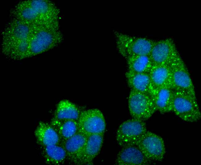 Phospho-AMPK alpha 2(S345) Rabbit mAb