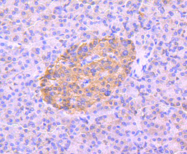 Phospho-AMPK alpha 2(S345) Rabbit mAb