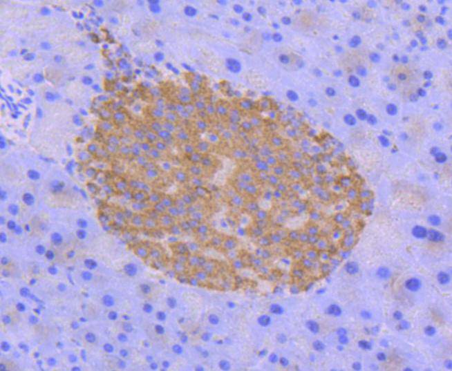 Phospho-AMPK alpha 2(S345) Rabbit mAb