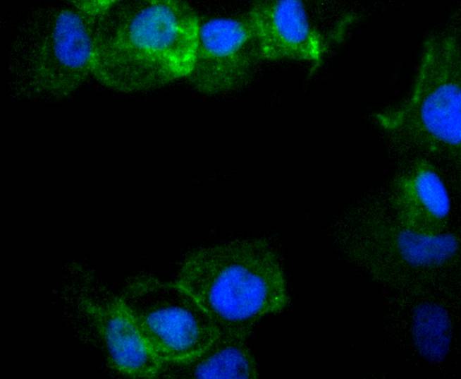 Phospho-Rac1+Cdc42(Ser71) Rabbit mAb