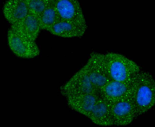 Phospho-Rac1+Cdc42(Ser71) Rabbit mAb