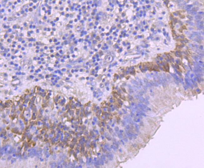 Phospho-Rac1+Cdc42(Ser71) Rabbit mAb