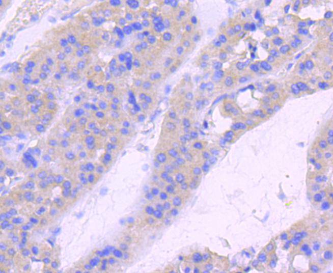 Phospho-Rac1+Cdc42(Ser71) Rabbit mAb