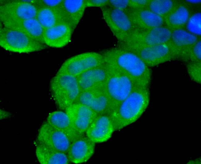 Phospho-PTEN(S380) Rabbit mAb