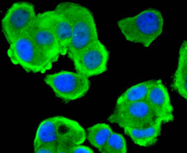 Phospho-PTEN(S380) Rabbit mAb