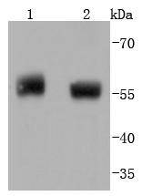 Phospho-PTEN(S380) Rabbit mAb