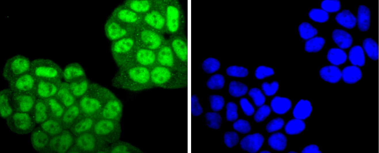 Phospho-PKC alpha (T638) Rabbit mAb