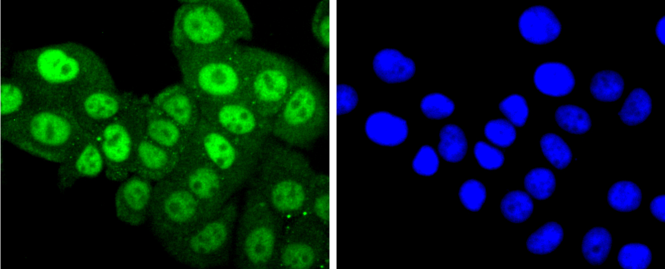 Phospho-PKC alpha (T638) Rabbit mAb