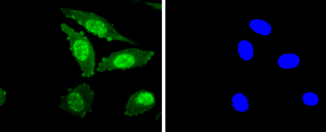 Phospho-PKC alpha (T638) Rabbit mAb