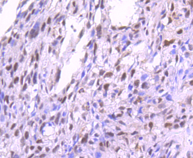 Phospho-PKC alpha (T638) Rabbit mAb